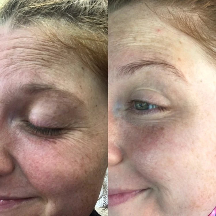 LIYALAN Retinol Serum