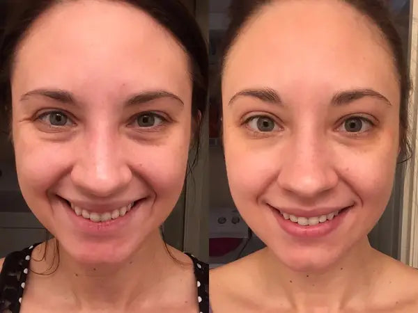 CARELAB HA Serum