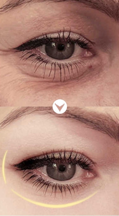 LIYALAN 60 Second Wrinkle Reducer