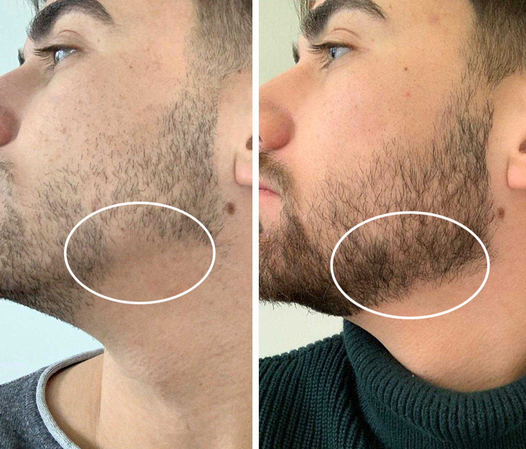 MASC Beard Elixir Balm