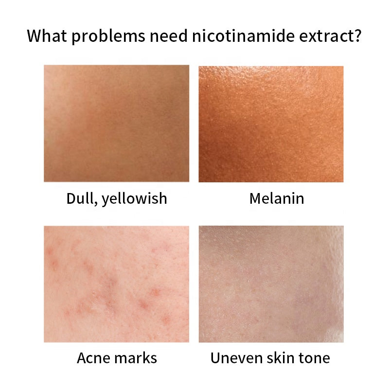 LIYALAN Nicotinamide Serum