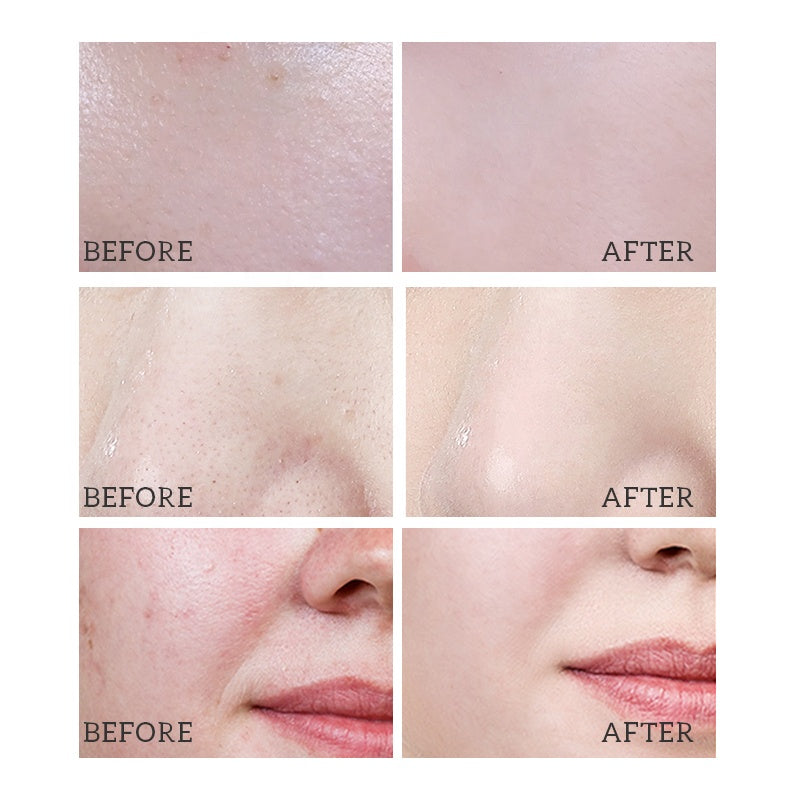 LIYALAN Hydrojelly Mask