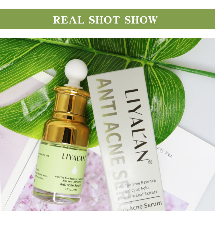 LIYALAN Anti Acne Salicylic Acid Serum