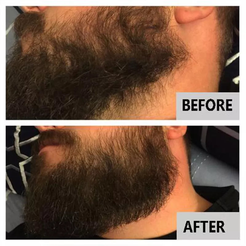 LIYALAN Beard Oil