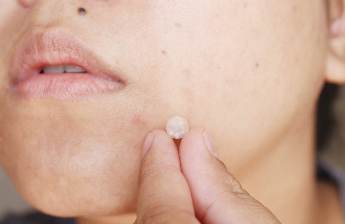 LIYALAN Acne Patches