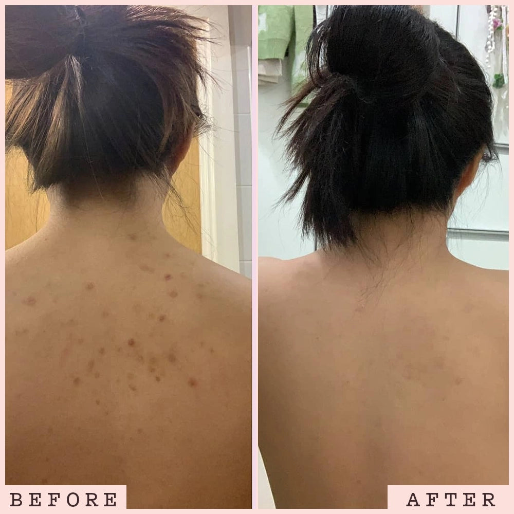 LIYALAN Matcha Green Tea Scrub