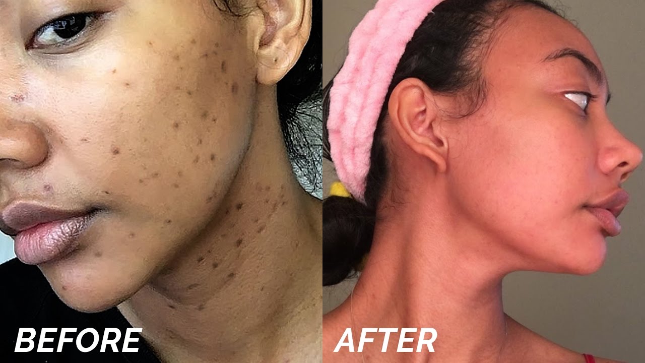 LIYALAN Turmeric Face Oil