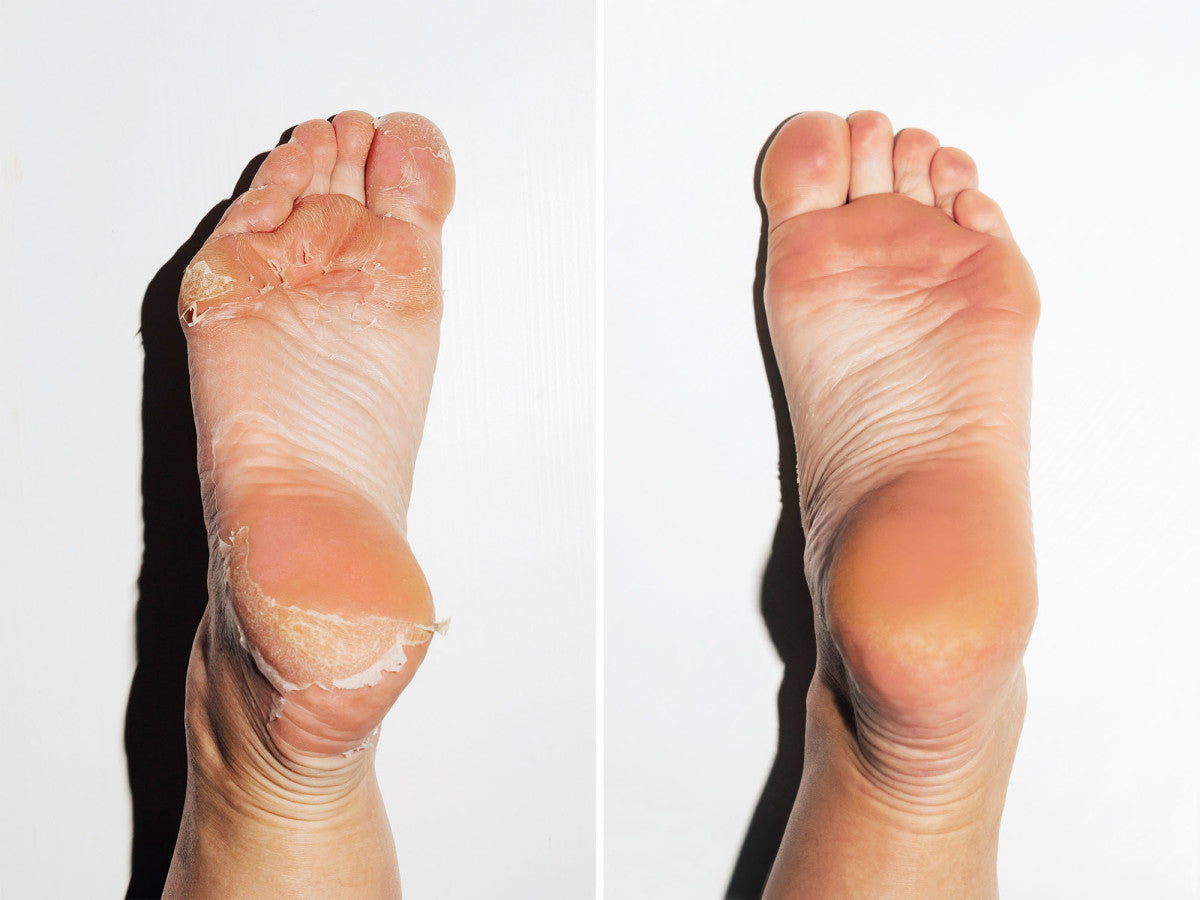 LIYALAN Baby Foot Peel Mask