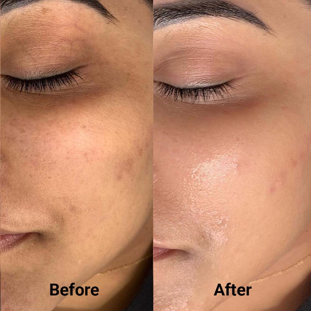 LIYALAN 24k Gold Strawberry Complex Serum