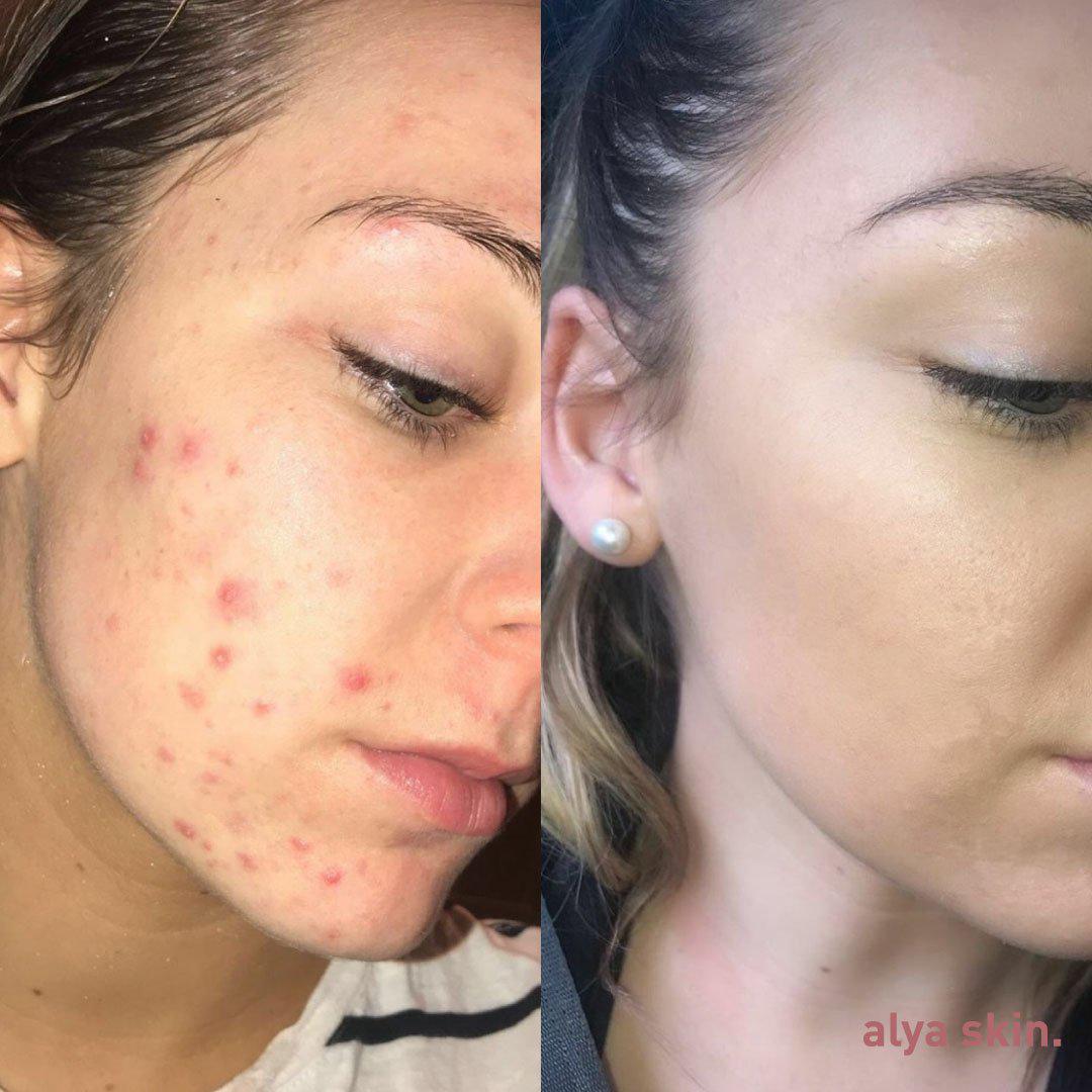 LIYALAN Green Tea Mask Stick
