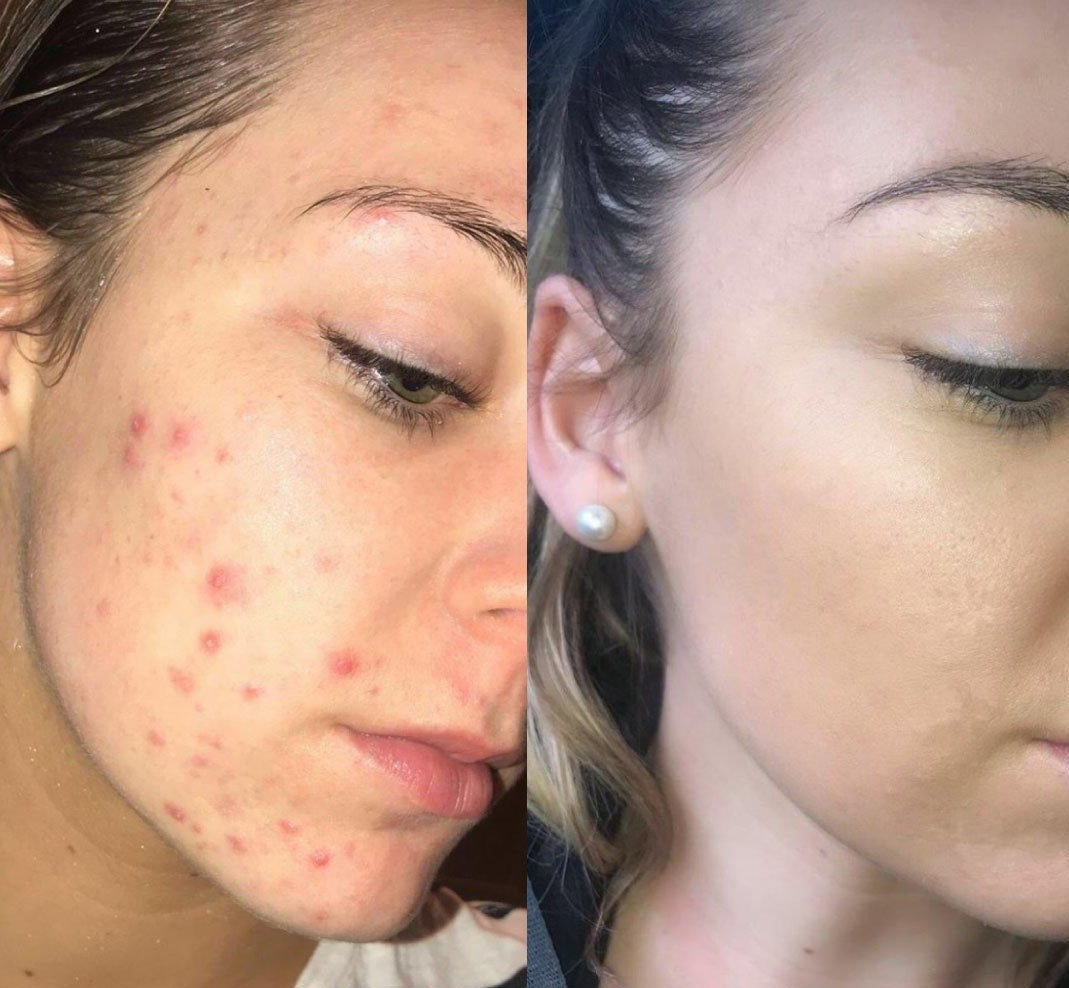 LIYALAN Green Tea Mask Stick
