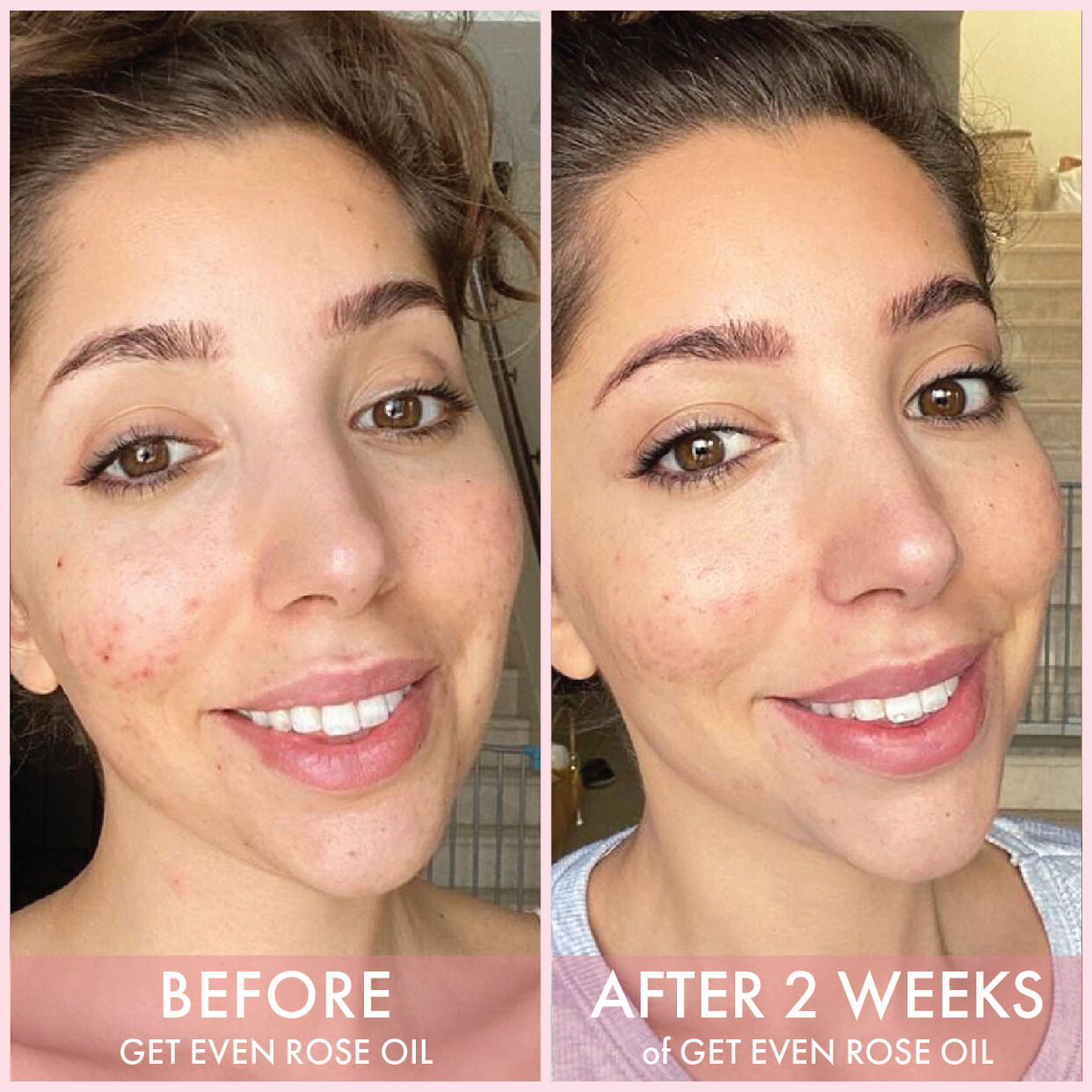 LIYALAN Rose Glow Facial Oil