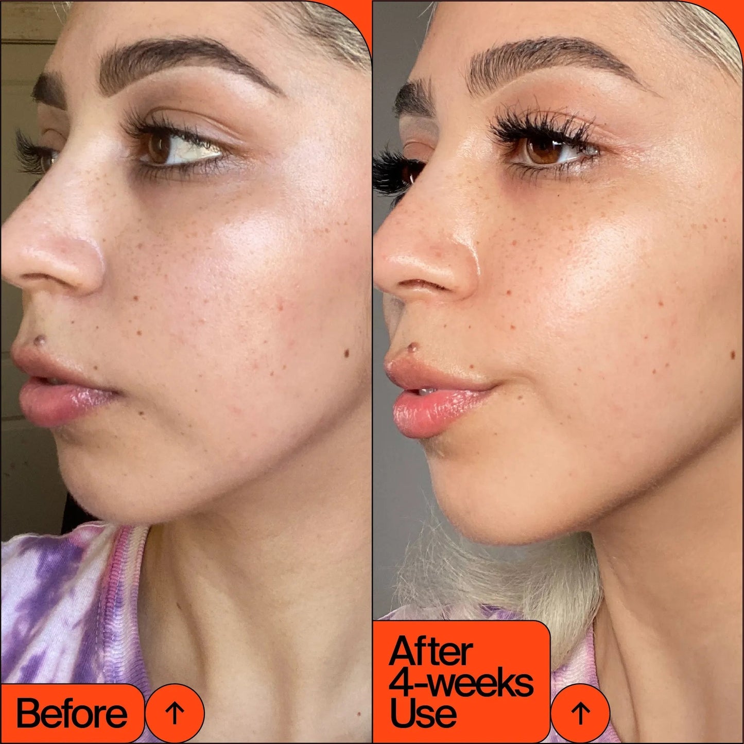 LIYALAN Vitamin C Serum