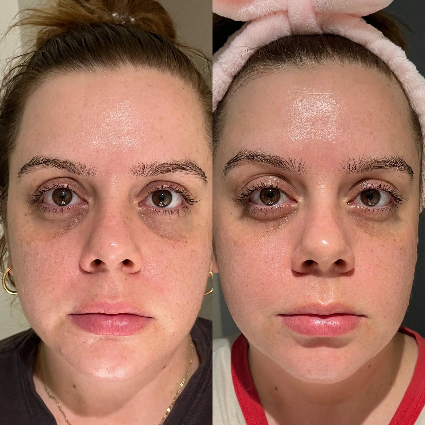 LIYALAN Skin Renewing Night Cream