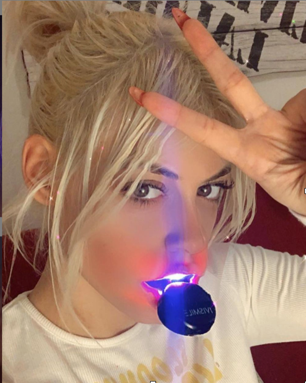 IVISMILE Wireless Light Smart LED Teeth Whitening Kit 4.0