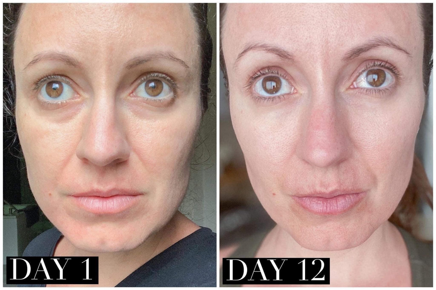 LIYALAN Skin Renewing Night Cream