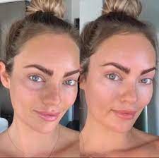 LIYALAN Hyaluronic Acid Hydrogel Eye Mask (Revitalise and Restore)