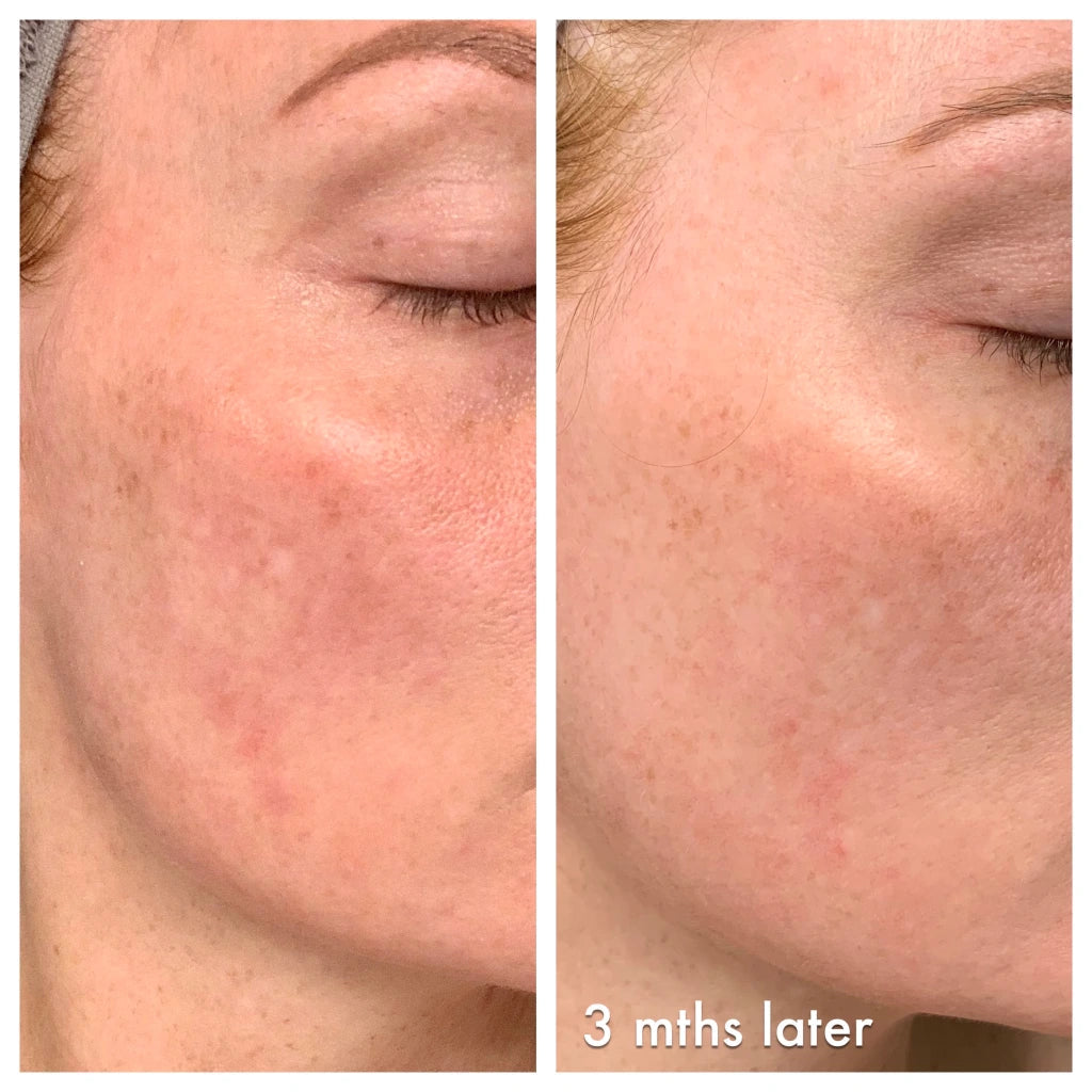 LIYALAN Vitamin C Serum