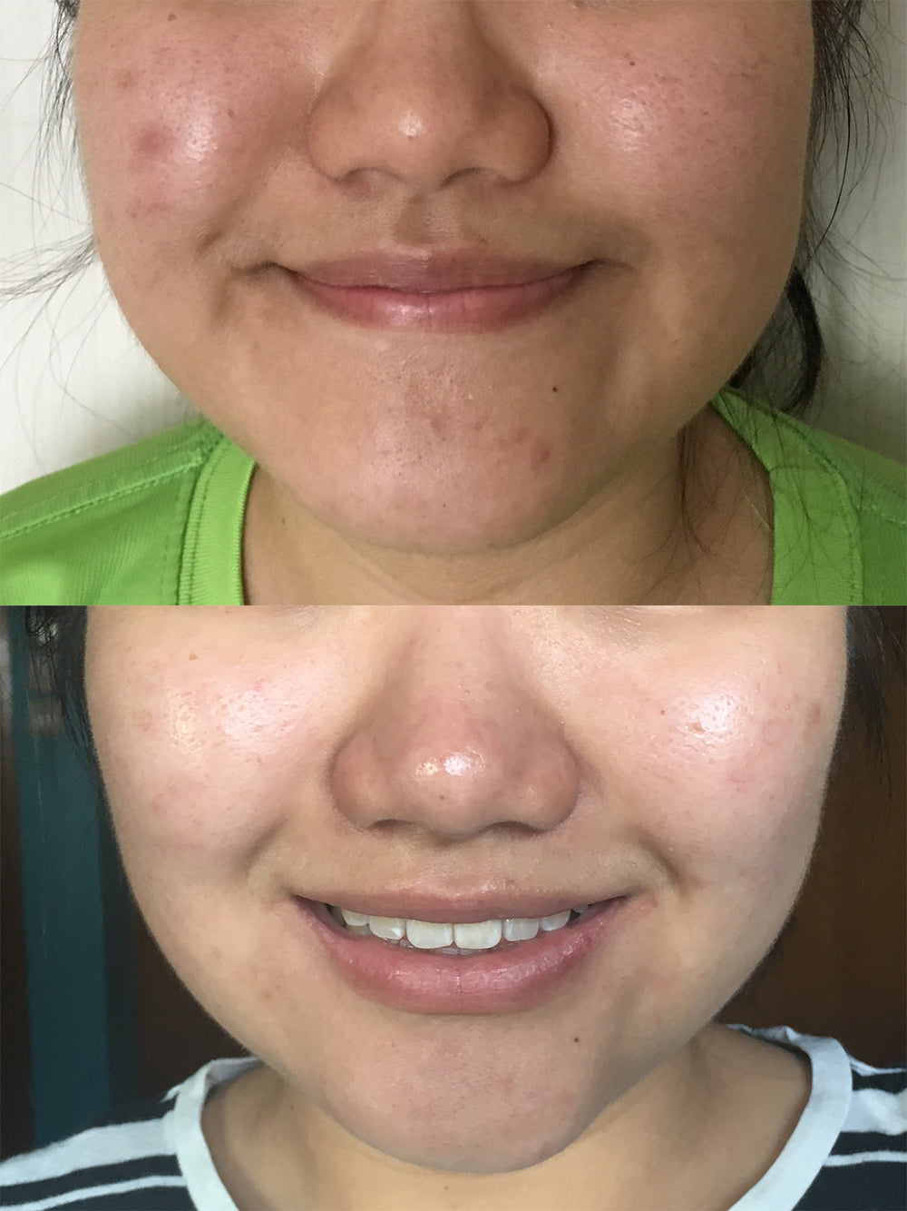 LIYALAN Turmeric Serum
