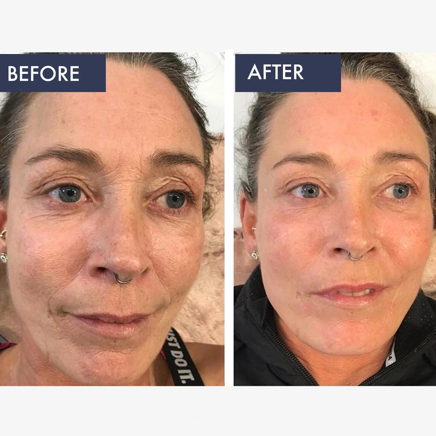 LIYALAN Retinol Serum