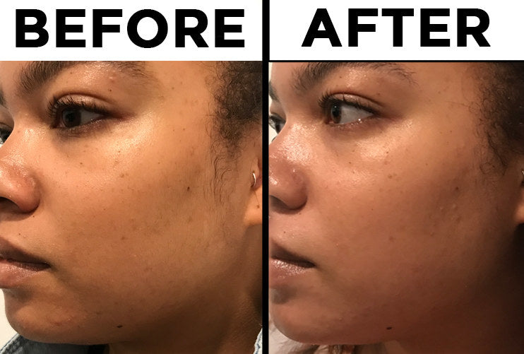 LIYALAN B5 Serum