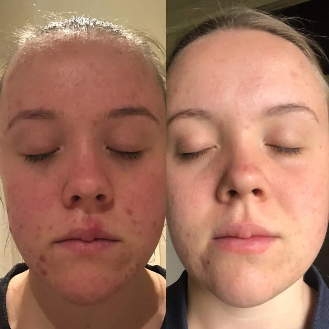 LIYALAN B5 Serum