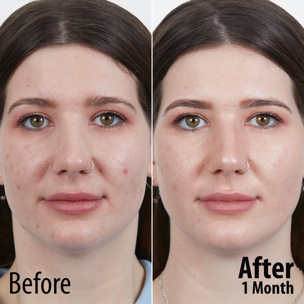 LIYALAN 24K Caviar Serum